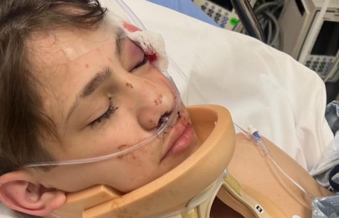 Le terrificanti immagini dell’incidente di Nidal Wonder mentre la famiglia conferma che il popolare YouTuber è in attesa di essere dimesso dall’ospedale