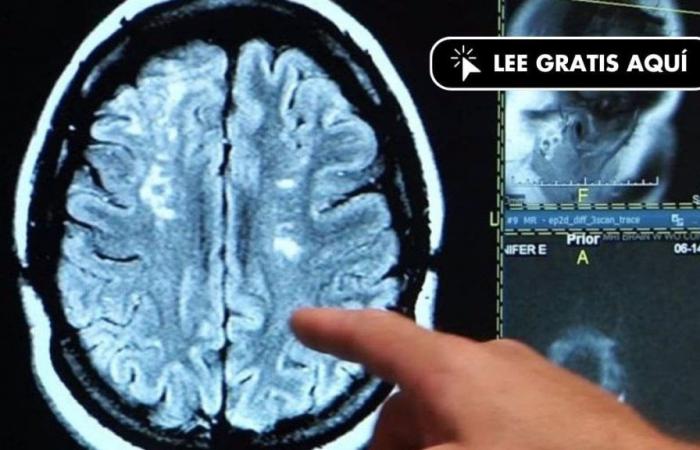 Una nuova tecnica consente una visione senza precedenti del cervello in tempi record