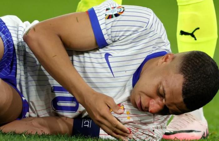 Il suo infortunio al naso durante la partita contro la Francia. L’Austria per gli Europei