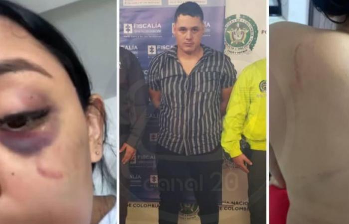 Bucaramanga: uomo catturato per aver aggredito la sua ex compagna con le forbici