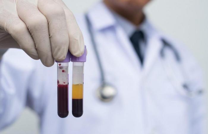 Le malattie del sangue sono all’avanguardia nella medicina personalizzata, raggiungendo tassi di sopravvivenza record