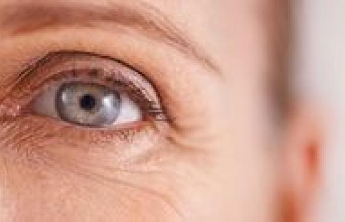Quali sono i sintomi dell’occhio secco e come prevenirlo